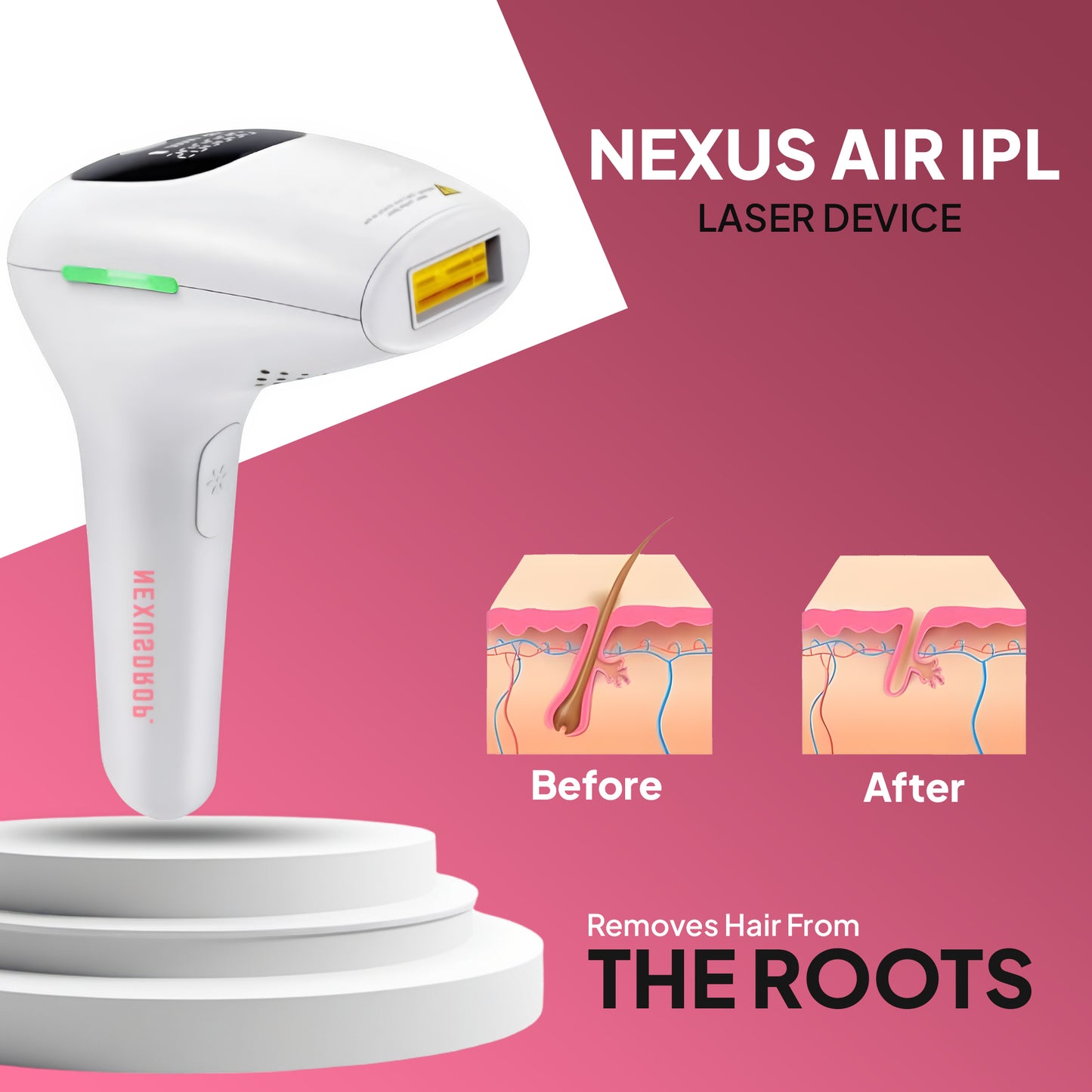 Nexus Air IPL Laser Device